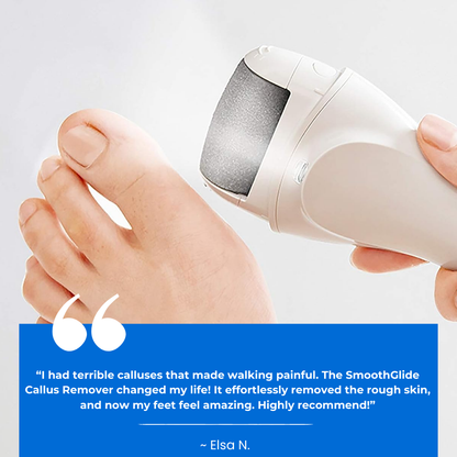 SmoothGlide™ Callus Remover