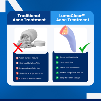 LumaClear™ - Acne Treatment